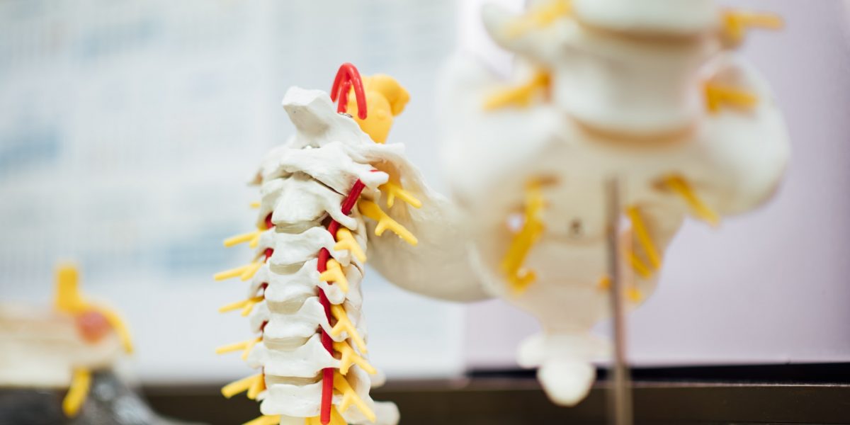 back-pain